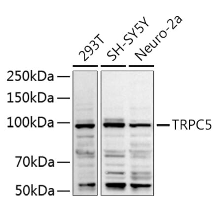 Western Blot - Anti-TRPC5 Antibody (A8522) - Antibodies.com