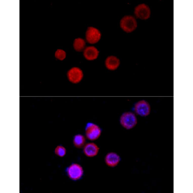 Immunofluorescence - Anti-TRPC5 Antibody (A8522) - Antibodies.com