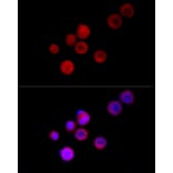 Immunofluorescence - Anti-TRPC5 Antibody (A8522) - Antibodies.com