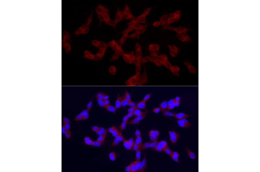 Immunofluorescence - Anti-TRPC5 Antibody (A8522) - Antibodies.com