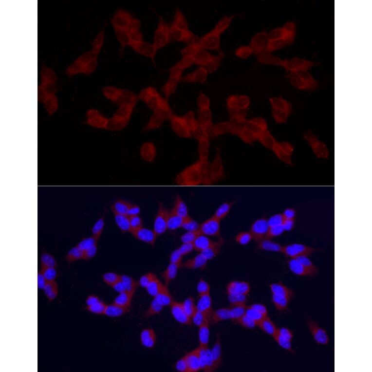 Immunofluorescence - Anti-TRPC5 Antibody (A8522) - Antibodies.com