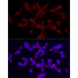 Immunofluorescence - Anti-TRPC5 Antibody (A8522) - Antibodies.com