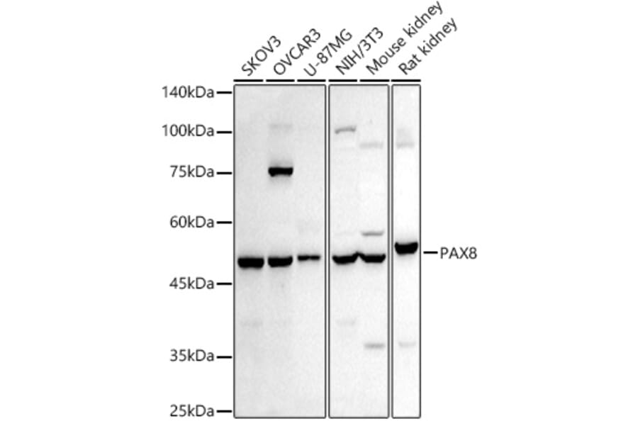 Western Blot - Anti-PAX8 Antibody (A8523) - Antibodies.com