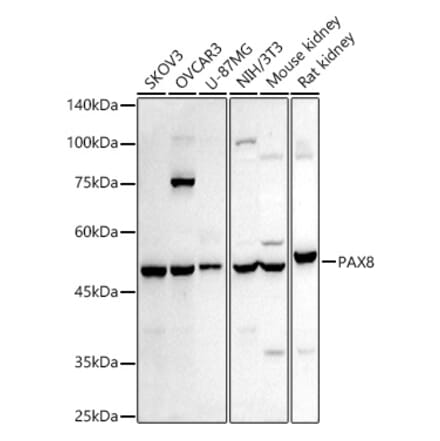 Western Blot - Anti-PAX8 Antibody (A8523) - Antibodies.com