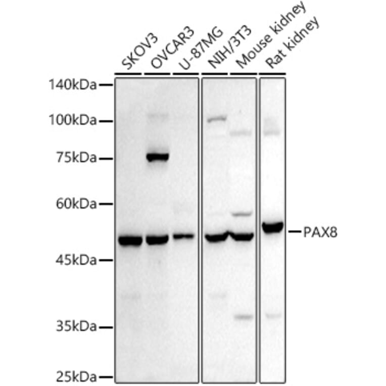 Western Blot - Anti-PAX8 Antibody (A8523) - Antibodies.com