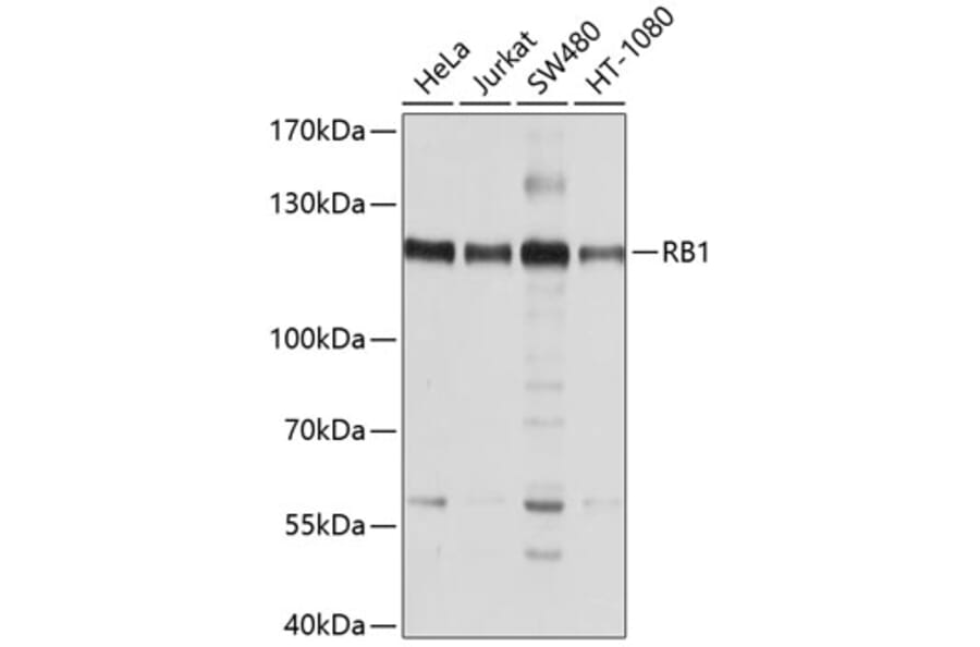 Western Blot - Anti-RB Antibody (A10094) - Antibodies.com