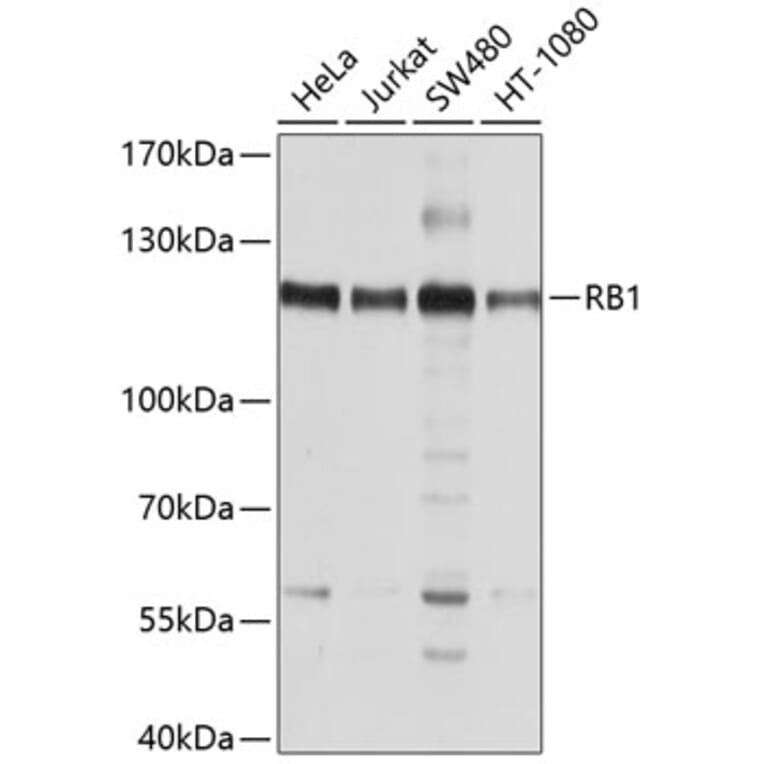 Western Blot - Anti-RB Antibody (A10094) - Antibodies.com