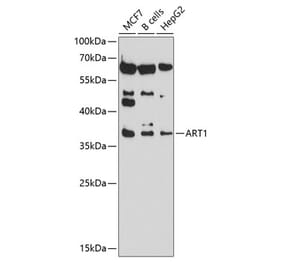 Western Blot - Anti-ART1 Antibody (A8527) - Antibodies.com