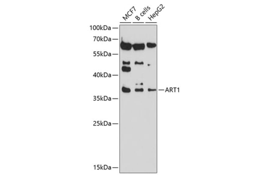 Western Blot - Anti-ART1 Antibody (A8527) - Antibodies.com