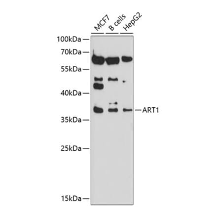Western Blot - Anti-ART1 Antibody (A8527) - Antibodies.com