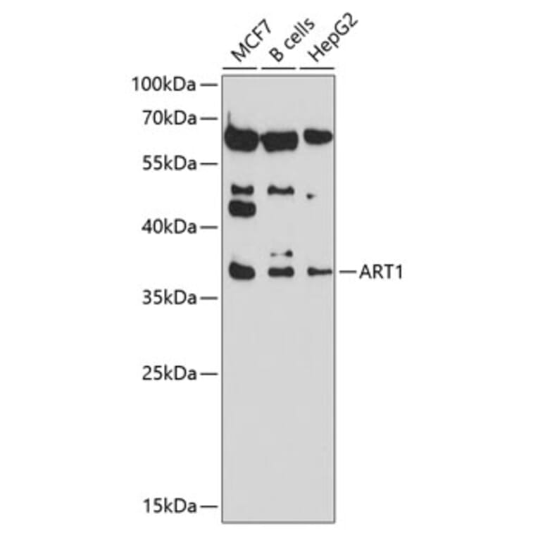 Western Blot - Anti-ART1 Antibody (A8527) - Antibodies.com