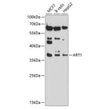 Western Blot - Anti-ART1 Antibody (A8527) - Antibodies.com