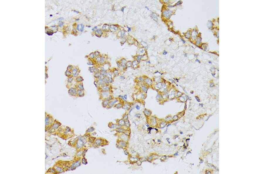 Immunohistochemistry - Anti-ART1 Antibody (A8527) - Antibodies.com