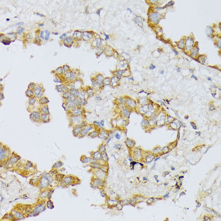 Immunohistochemistry - Anti-ART1 Antibody (A8527) - Antibodies.com