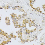 Immunohistochemistry - Anti-ART1 Antibody (A8527) - Antibodies.com