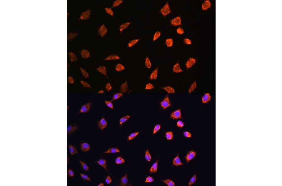 Immunofluorescence - Anti-ART1 Antibody (A8527) - Antibodies.com