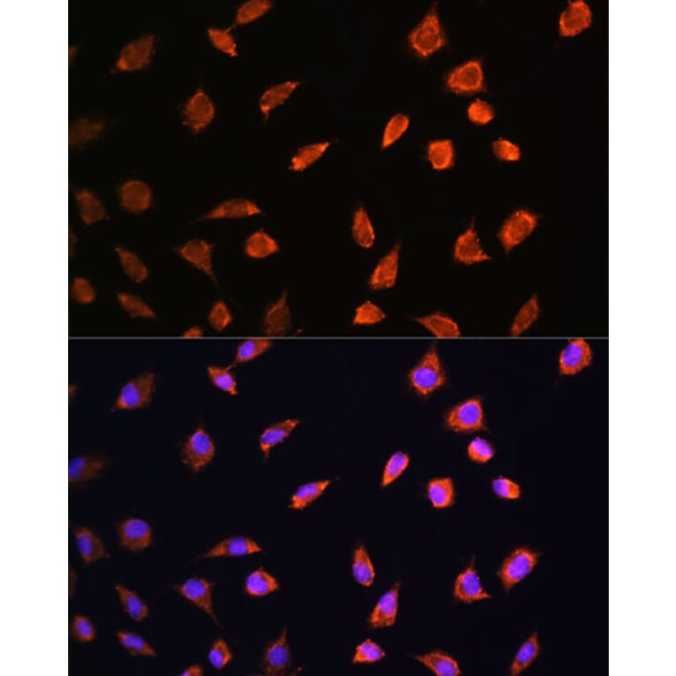 Immunofluorescence - Anti-ART1 Antibody (A8527) - Antibodies.com