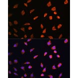 Immunofluorescence - Anti-ART1 Antibody (A8527) - Antibodies.com