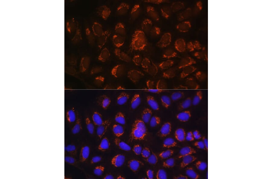 Immunofluorescence - Anti-ART1 Antibody (A8527) - Antibodies.com