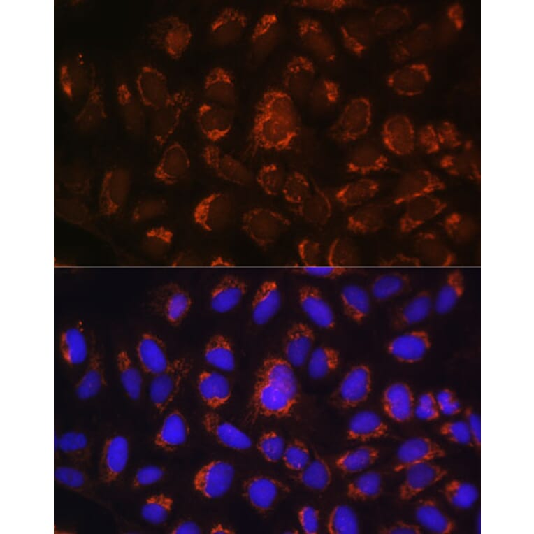 Immunofluorescence - Anti-ART1 Antibody (A8527) - Antibodies.com