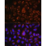 Immunofluorescence - Anti-ART1 Antibody (A8527) - Antibodies.com