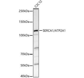 Western Blot - Anti-SERCA1 ATPase Antibody (A8528) - Antibodies.com