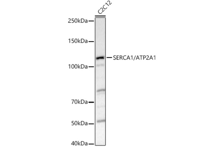 Western Blot - Anti-SERCA1 ATPase Antibody (A8528) - Antibodies.com