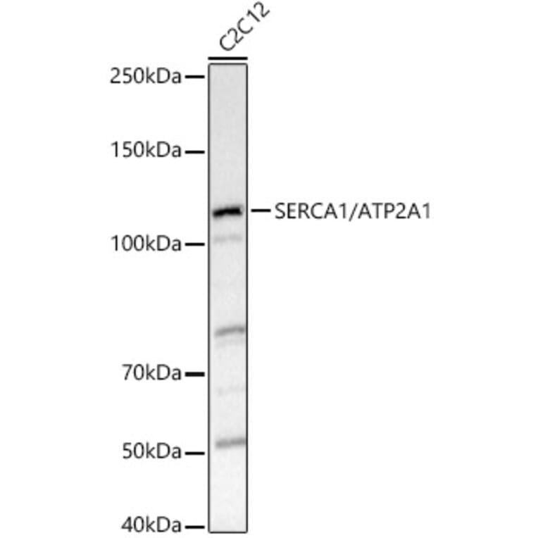 Western Blot - Anti-SERCA1 ATPase Antibody (A8528) - Antibodies.com