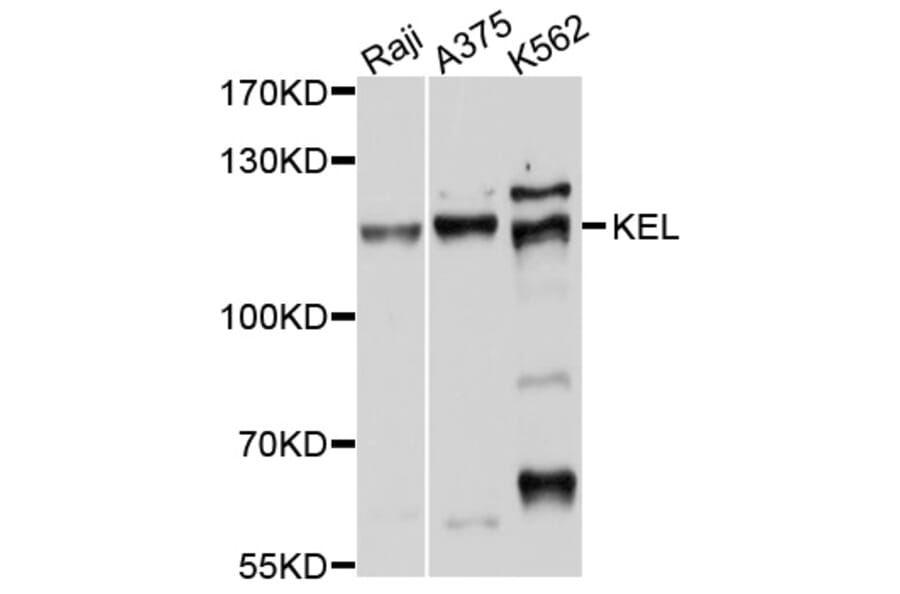 Western Blot - Anti-KEL Antibody (A10116) - Antibodies.com