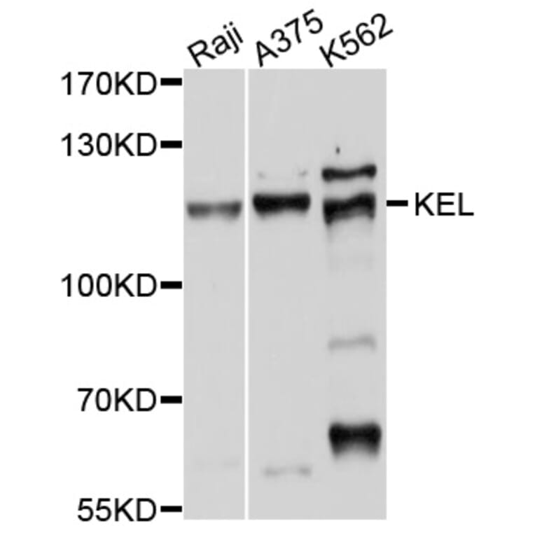 Western Blot - Anti-KEL Antibody (A10116) - Antibodies.com
