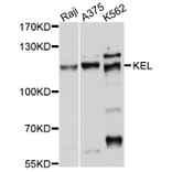 Western Blot - Anti-KEL Antibody (A10116) - Antibodies.com