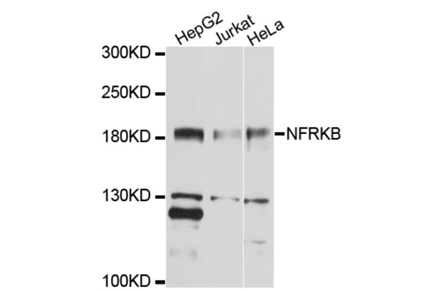 Western Blot - Anti-NFRKB Antibody (A10124) - Antibodies.com