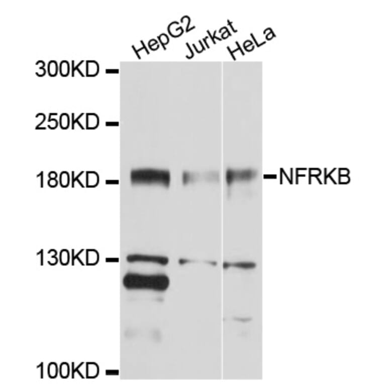 Western Blot - Anti-NFRKB Antibody (A10124) - Antibodies.com