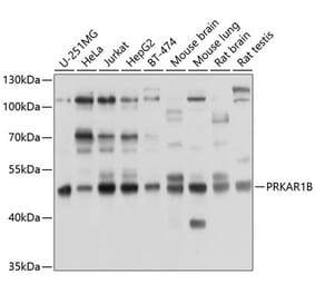 Western Blot - Anti-PRKAR1B Antibody (A8531) - Antibodies.com