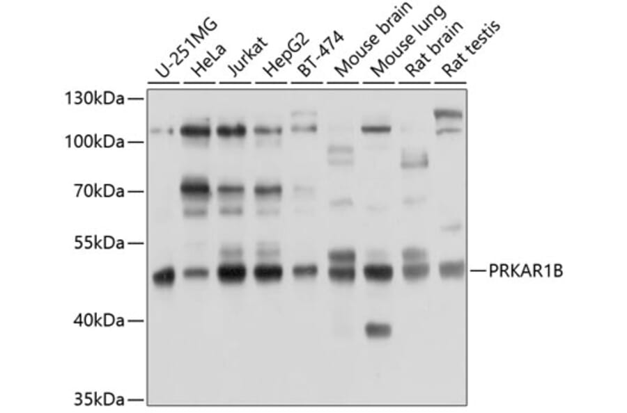 Western Blot - Anti-PRKAR1B Antibody (A8531) - Antibodies.com