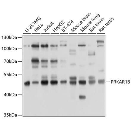 Western Blot - Anti-PRKAR1B Antibody (A8531) - Antibodies.com
