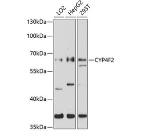 Western Blot - Anti-CYP4F2 Antibody (A8532) - Antibodies.com