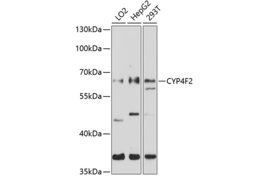Western Blot - Anti-CYP4F2 Antibody (A8532) - Antibodies.com