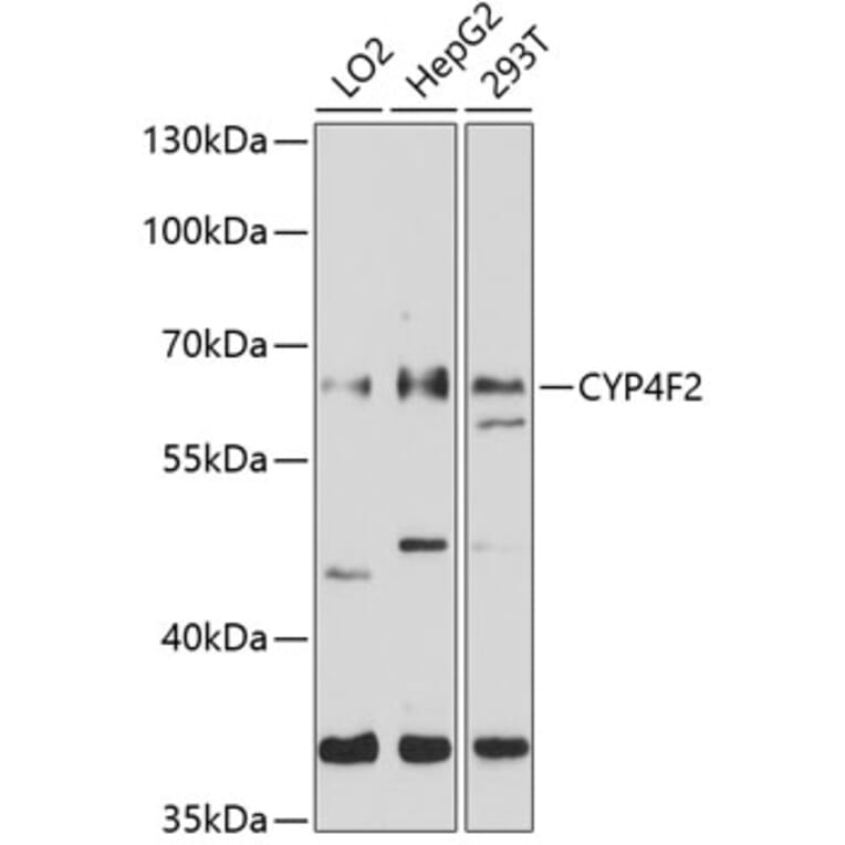 Western Blot - Anti-CYP4F2 Antibody (A8532) - Antibodies.com