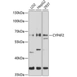 Western Blot - Anti-CYP4F2 Antibody (A8532) - Antibodies.com