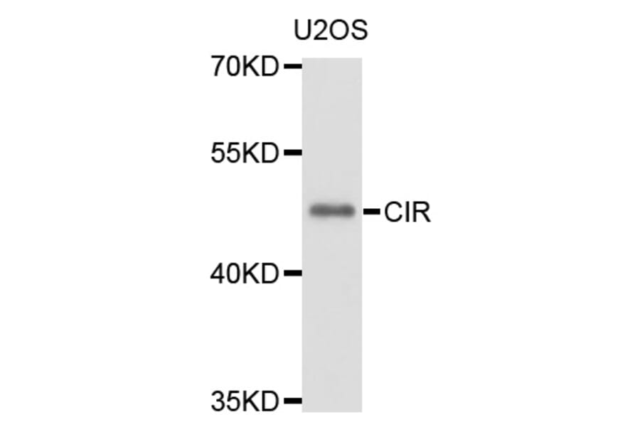 Western Blot - Anti-CIR1 Antibody (A10133) - Antibodies.com