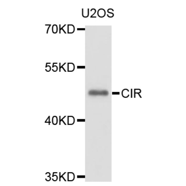 Western Blot - Anti-CIR1 Antibody (A10133) - Antibodies.com
