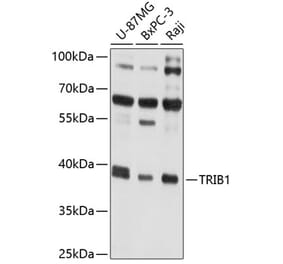 Western Blot - Anti-TRIB1 Antibody (A8534) - Antibodies.com