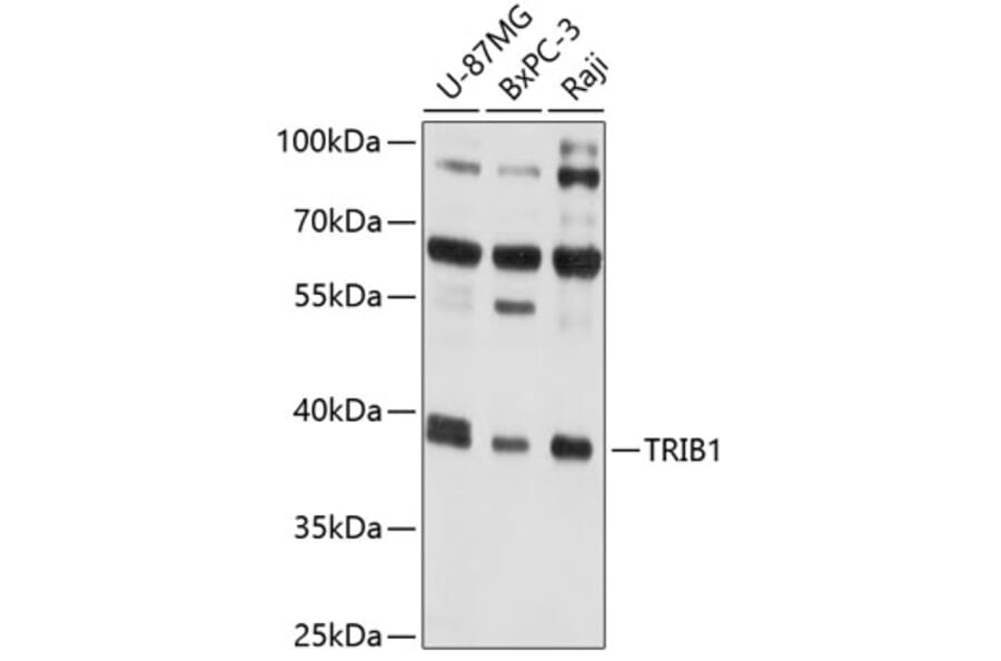 Western Blot - Anti-TRIB1 Antibody (A8534) - Antibodies.com