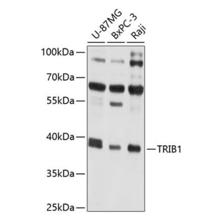 Western Blot - Anti-TRIB1 Antibody (A8534) - Antibodies.com
