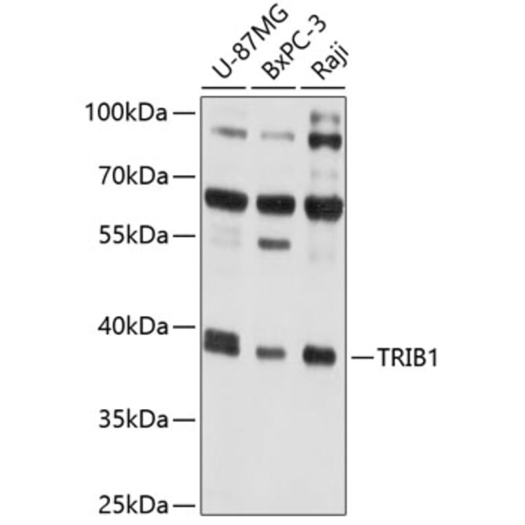 Western Blot - Anti-TRIB1 Antibody (A8534) - Antibodies.com