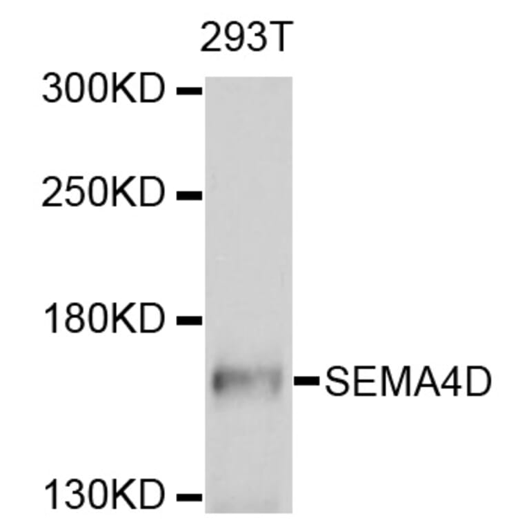 Western Blot - Anti-SEMA4D Antibody (A10136) - Antibodies.com