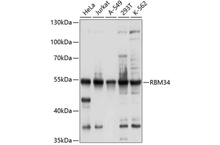 Western Blot - Anti-RBM34 Antibody (A8536) - Antibodies.com