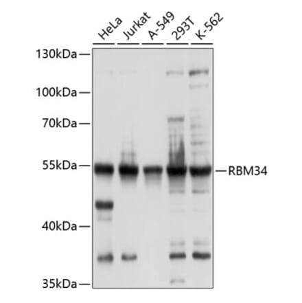 Western Blot - Anti-RBM34 Antibody (A8536) - Antibodies.com