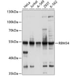 Western Blot - Anti-RBM34 Antibody (A8536) - Antibodies.com